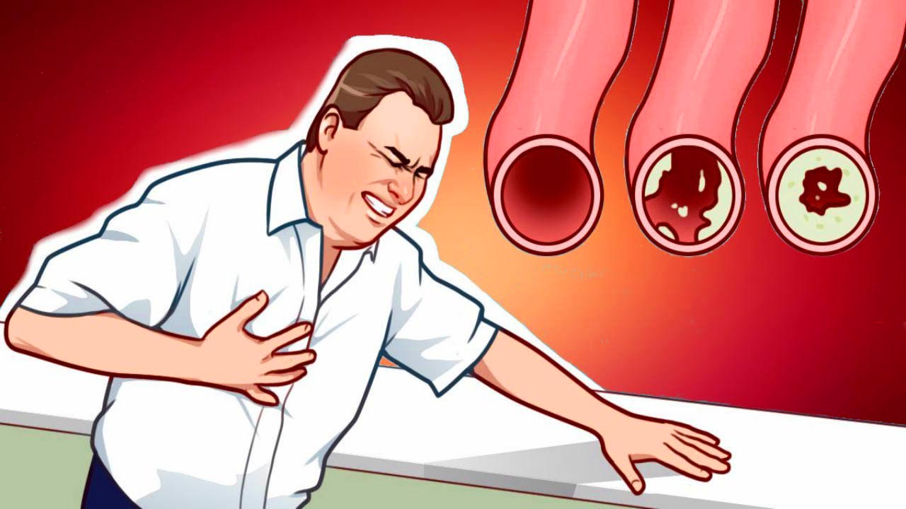 clean your arteries